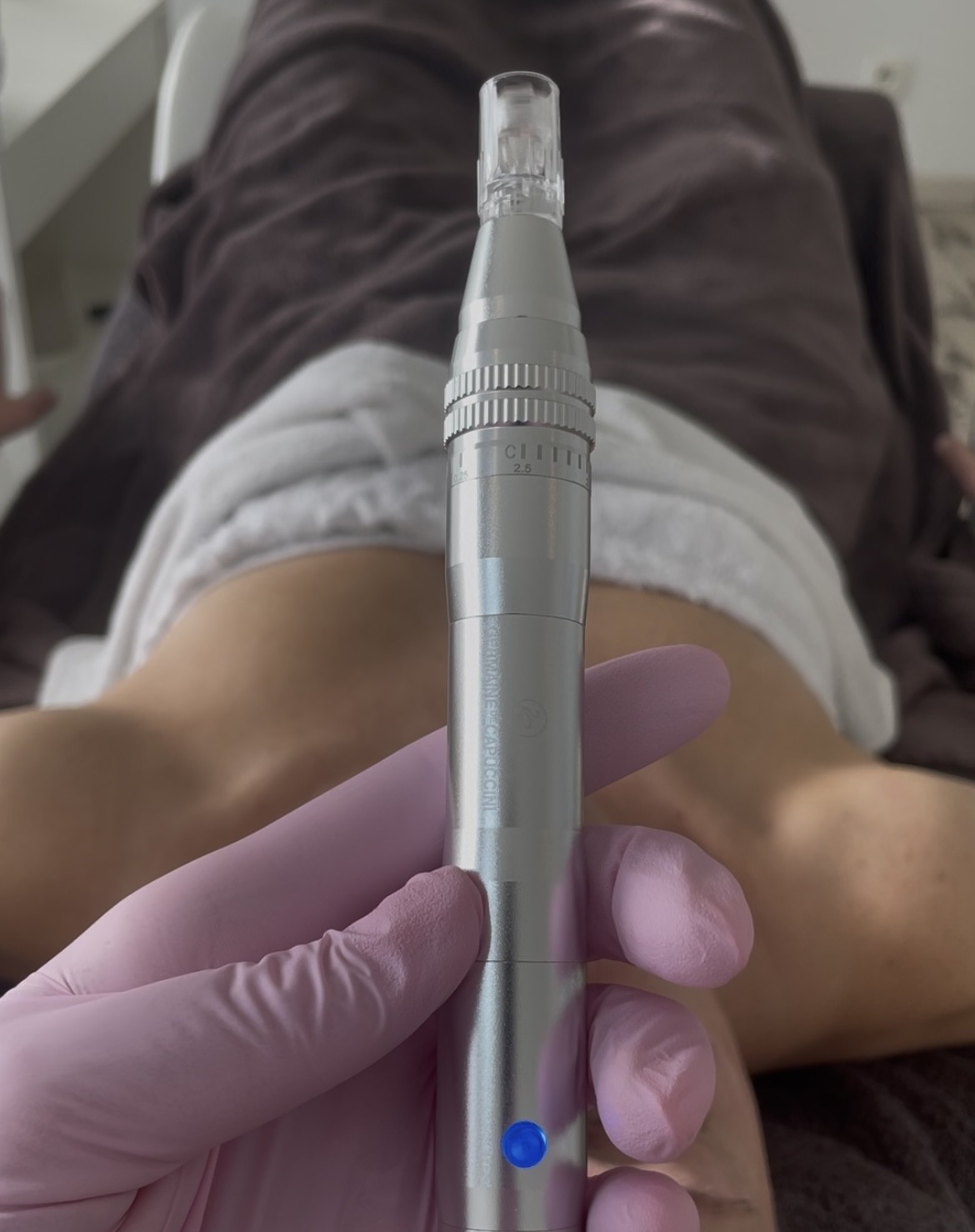 Dermatechpen/micro-needling